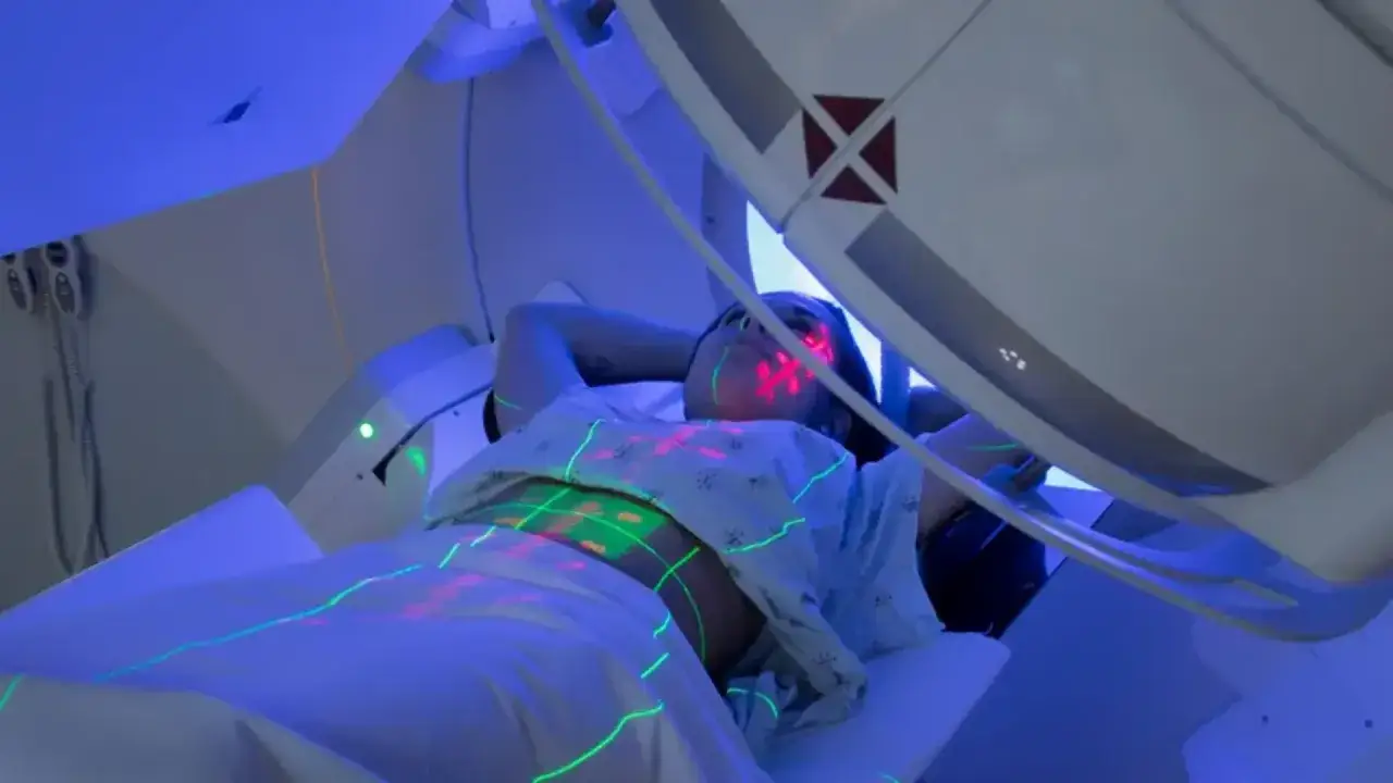 Pacjentka leży pod aparaturą do radioterapii, na jej ciele widoczne są zielone i czerwone linie naprowadzające. Tak wygląda na czym polega radioterapia.