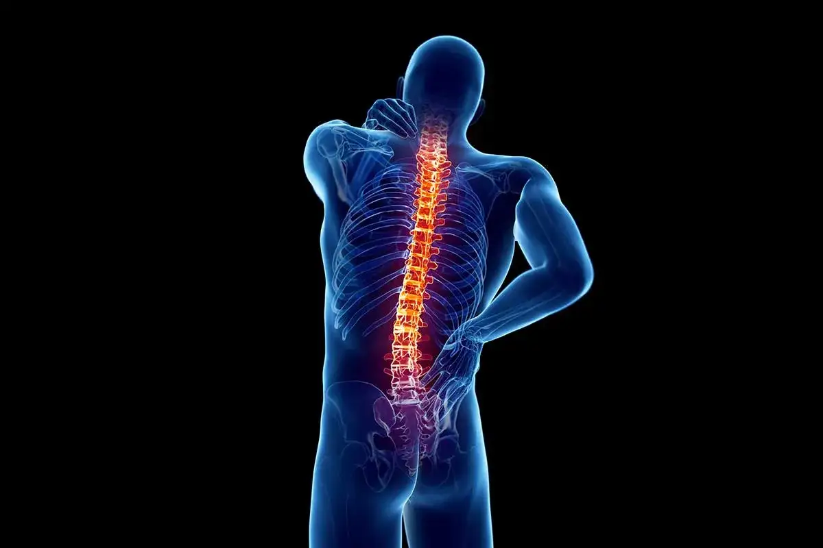 Ból kręgosłupa, który może być objawem osteoartrozy. Co to jest i jak sobie z tym radzić?