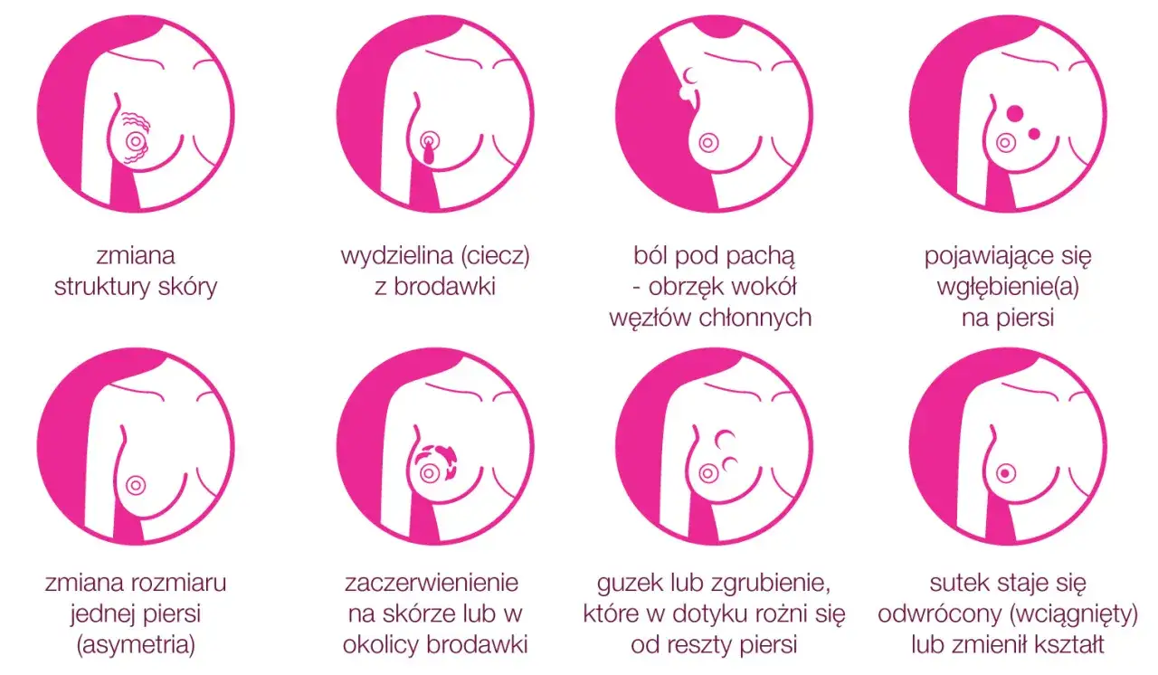 Grafika pokazuje objawy raka piersi: zmiany skórne, wydzielinę z brodawki, ból pod pachą, wgłębienia, asymetrię, zaczerwienienie, guzki i odwrócony sutek.