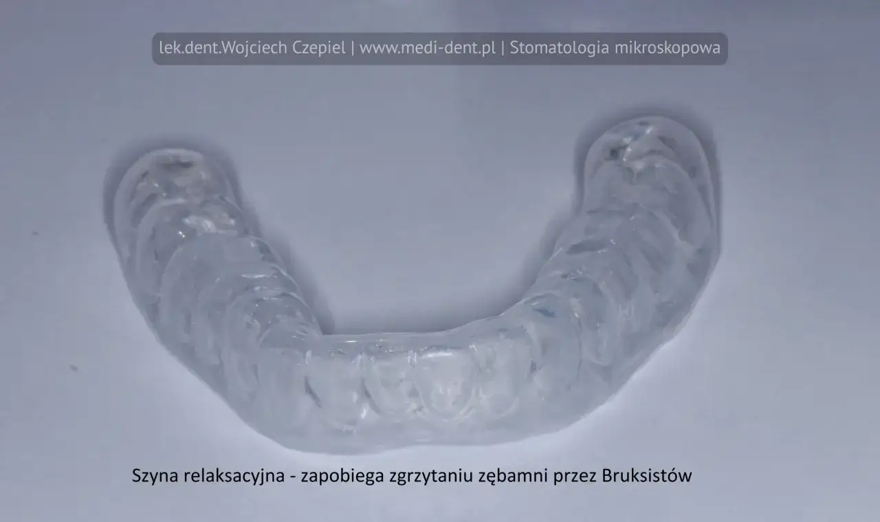 Przezroczysta szyna relaksacyjna, zapobiegająca parafunkcjom narządu żucia, takim jak zgrzytanie zębami.