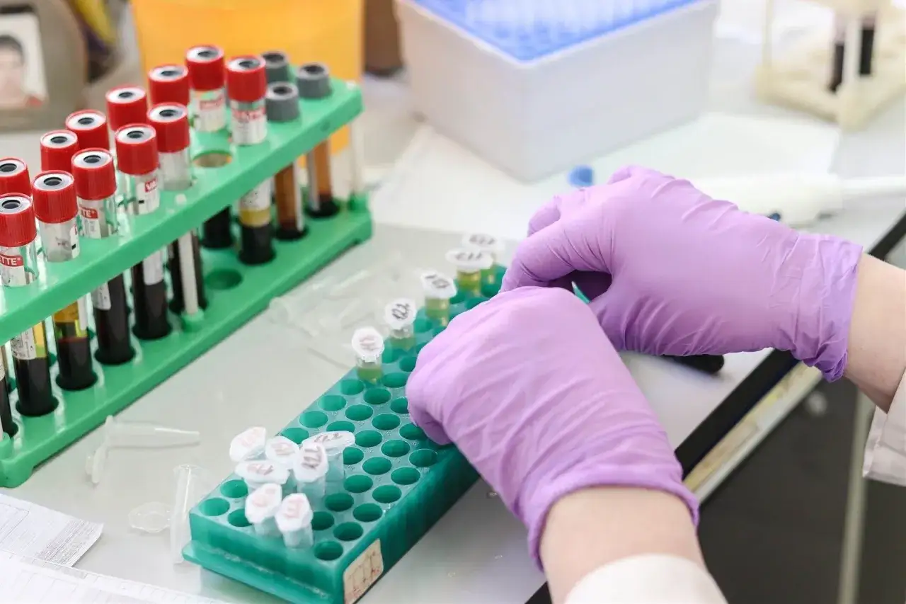 Ręce w fioletowych rękawiczkach pracują przy probówkach. Badania laboratoryjne, w tym te dotyczące wysokiego ASO i nowotworów, wymagają precyzji.