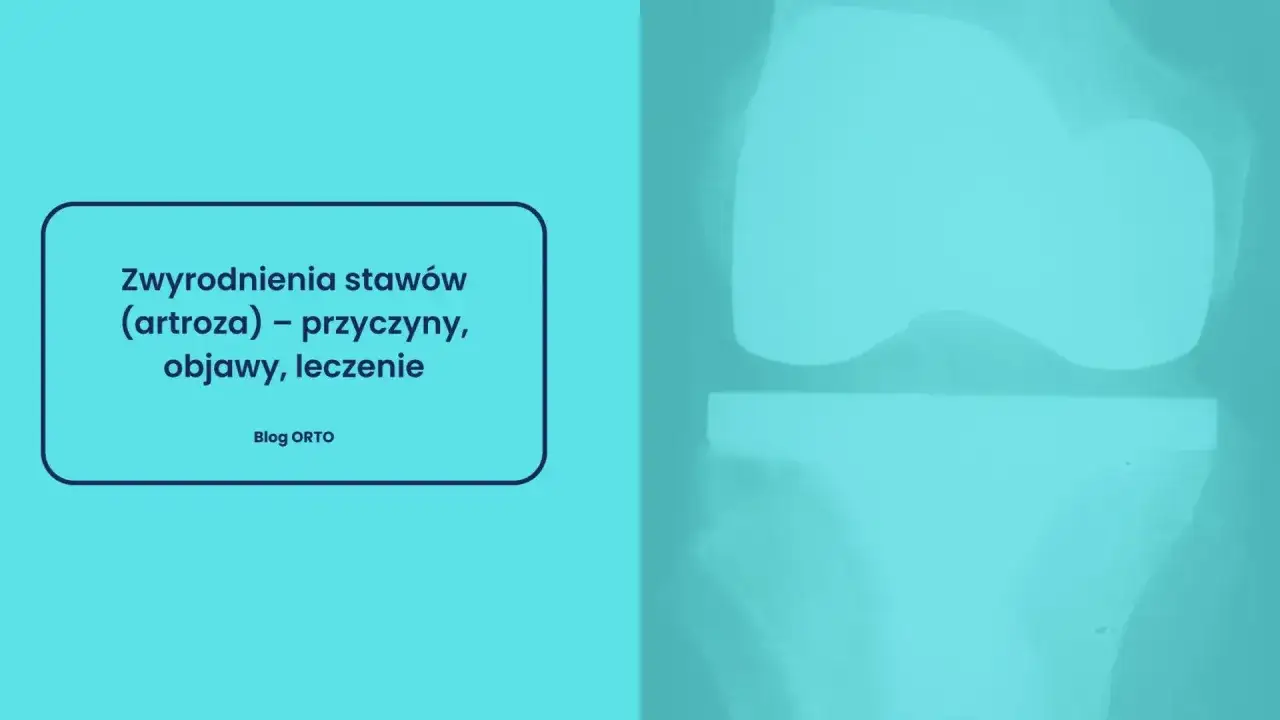 Zwyrodnienia stawów (artroza) – co to jest? Przyczyny, objawy i leczenie. Rentgen kolana.