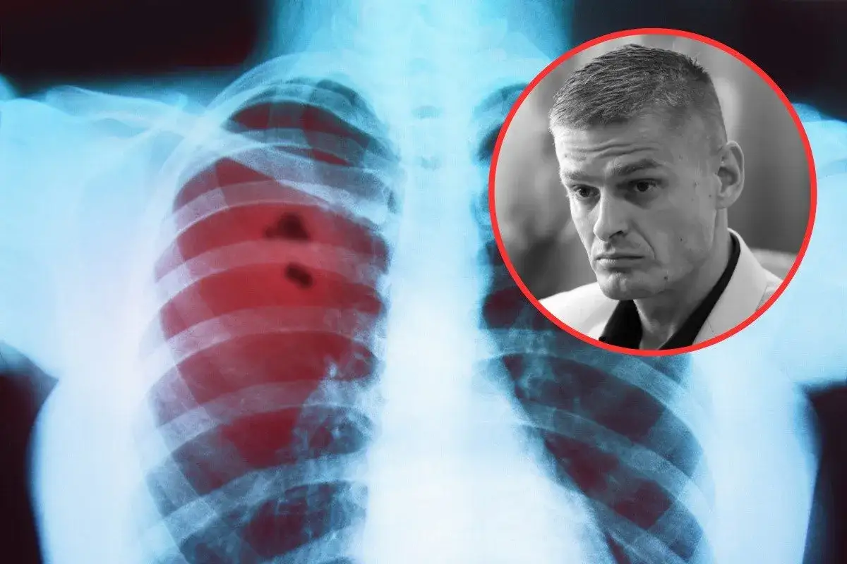 RTG płuc z zaczerwienionymi zmianami, sugerującymi kaszel przy raku płuc. Obok twarz mężczyzny w okręgu.
